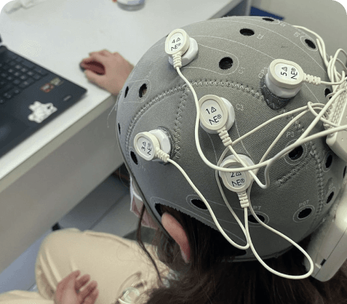 Consumibles para Neuromodulación