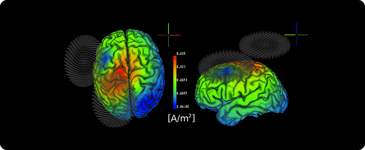 Estimulación Magnética Transcraneal (rTMS): La herramienta ideal frente al Alzheimer