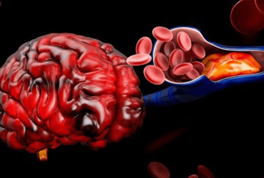 Imagen Doppler color para flujo cerebral y carotídeo
