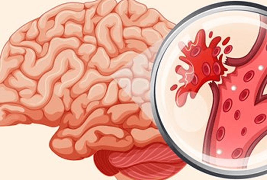 TCD portátil para evaluación neurovascular