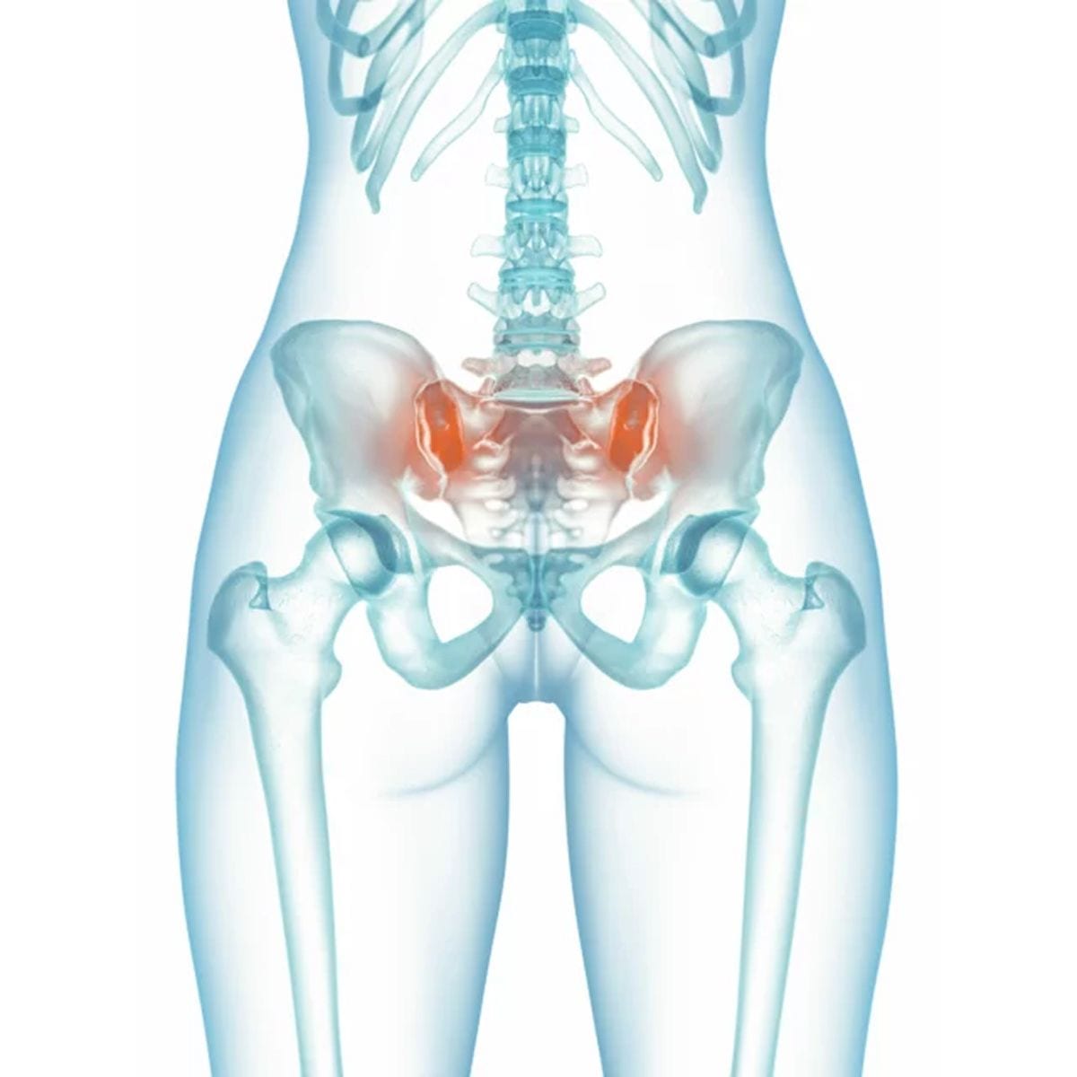 Guía dinámica SI — Sonda DSG pedicular PsiFGuard