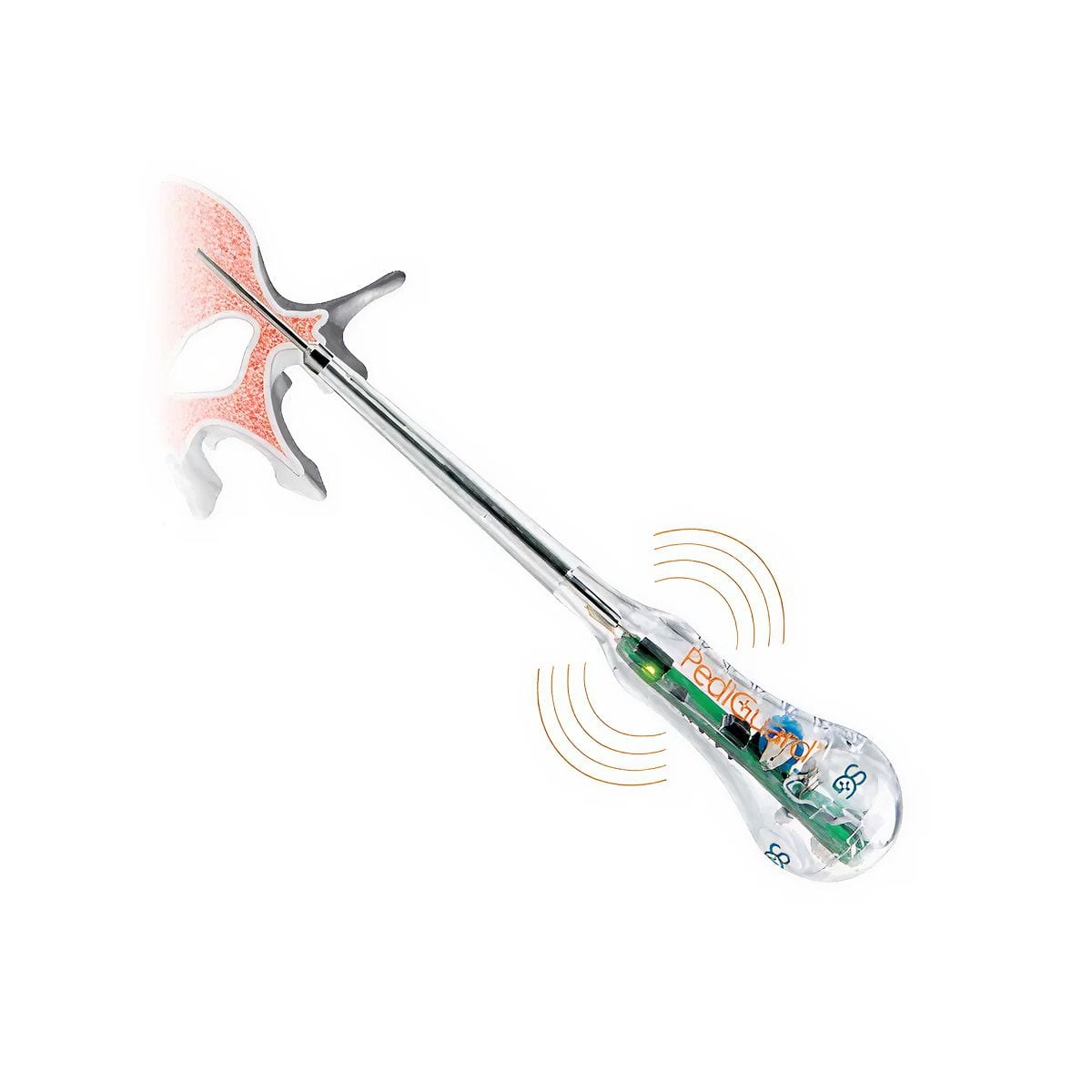 Sonda DSG pedicular Curved
