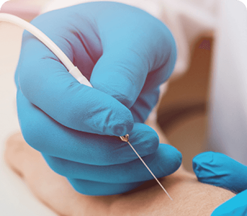Electromiografía (EMG) + Ultrasonido neuromuscular