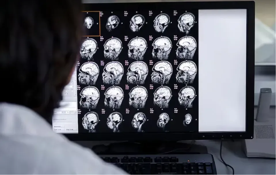 Neurovascular